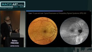 Retinal Diseases: How to Apply Recent Imaging Advances for Diagnosis ...