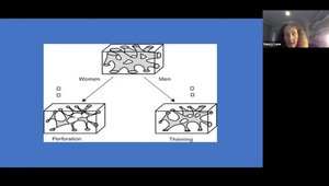 Women in Rheumatology: Sex Differences in Osteoporosis, Really!!! | Vumedi
