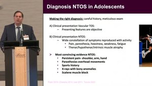 Thoracic Outlet Syndrome in Adolescents Is a Real Challenge | Vumedi
