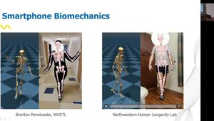 Opportunities of AI Powered Gait Analysis for Rehabilitation | Vumedi