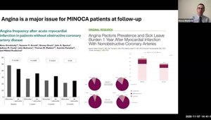 TCT 2025 Insights: Stratified Treatment of Myocardial Infarction with ...