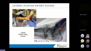 Critical Limb Ischemia & Peripheral Artery Disease | Vumedi