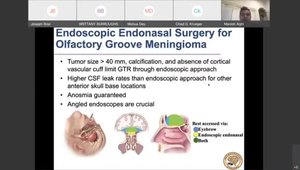 Surgical Approaches for Anterior Skull Base Meningiomas | Vumedi