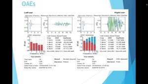 Hearing Loss Assessment in Adults and Children: Interpreting Audiometry ...