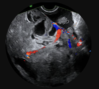 Gynaecology Ultrasound