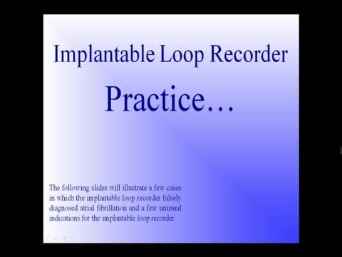 Implantable Loop Recorder: Techniques for Maximizing P Wave and ...