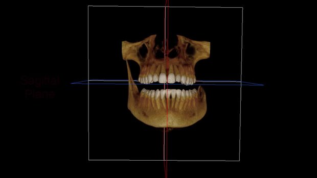 Coronal Sagittal Axial Planes