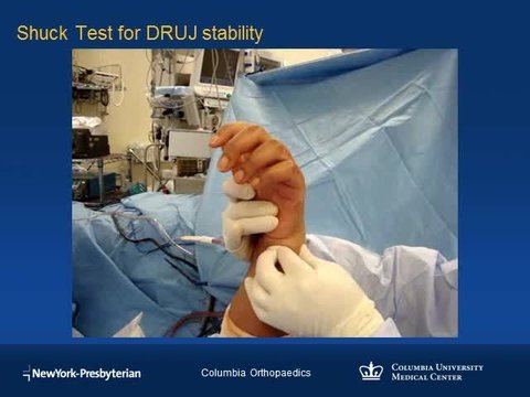 Case Discussion: DRUJ Stabilization Techniques | Vumedi