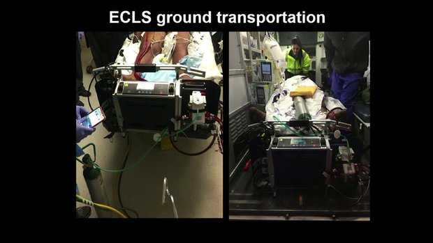 Extracorporeal Life Support (ECLS) in the ERA of Percutaneous ...