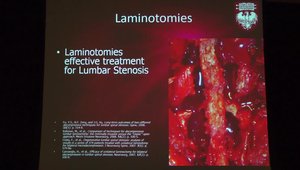 Module #3- Lumbar Stenosis – University of Chicago