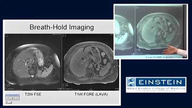 Introducing MRI: Fast Imaging Image Review | Vumedi