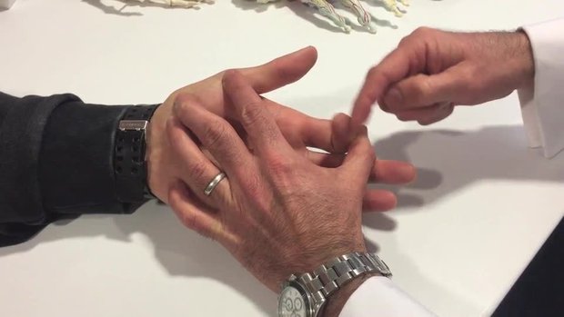 Reverse Elson's test for Boutonniere deformity | Vumedi