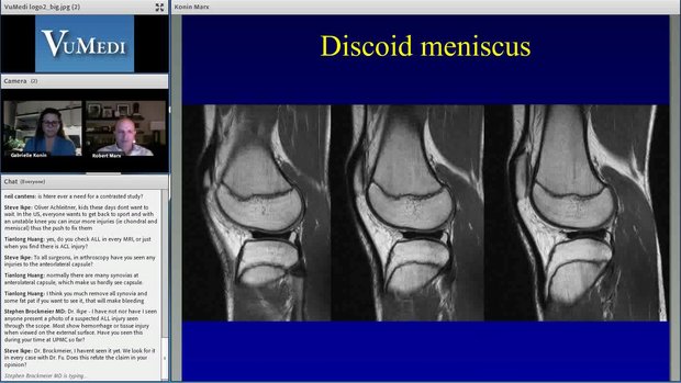 Meniscus: MRI - Arthroscopy Correlations | Vumedi