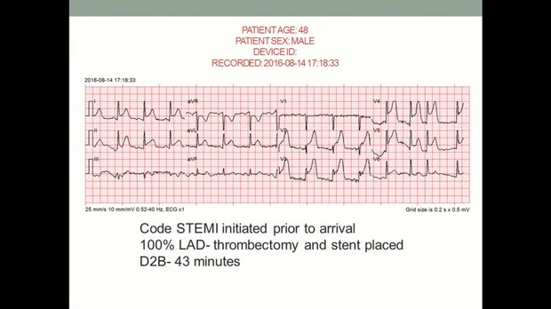 STEMI System of Care: Improving Care and Beating the Clock | Vumedi
