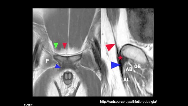 健康・医学 MRI ARTHROSCOPY and SURGICAL ANATOMY Mri, Arthroscopy, and Surgical Anatomy of the Joints
