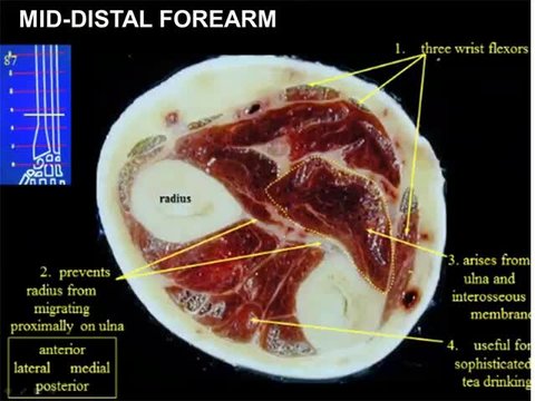 Anatomy of the Forearm | Vumedi