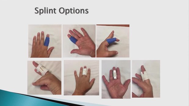 Occupational Therapy Regaining Function after Common Hand Injuries | Vumedi