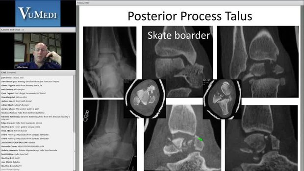 Talar Fractures: Anatomy, Imaging and Classification | Vumedi