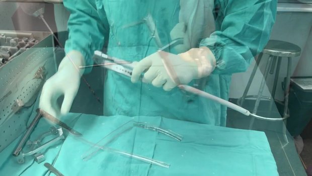 Self manufacturing of an antibiotic coated nail | Vumedi