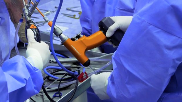 All-Inside ACL Reconstruction | Vumedi