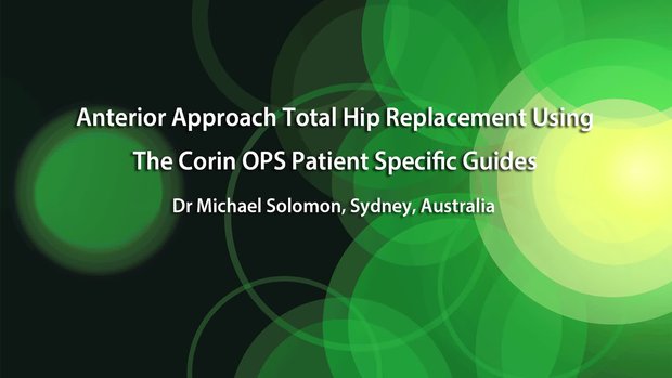 Anterior Approach Total Hip Replacement Using The Corin OPS Patient ...