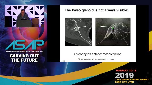 The ABC’s of the Gilles Walch Classification | Vumedi