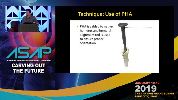 Allograft Prosthetic Technique for Humeral Bone Loss: Technique | Vumedi
