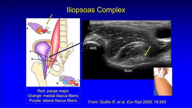 Musculoskeletal Ultrasound: Dynamic Imaging | Vumedi