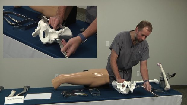 Anterior Approach Demonstration - Acetabular Retractor Placement for ...