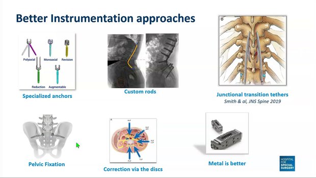 裁断済　脊椎脊髄病学 = PRINCIPLES OF SPINAL DISOR 裁断済 脊椎脊髄病学 = PRINCIPLES OF SPINAL DISOR