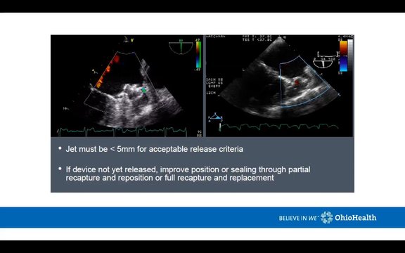 Understanding Watchman: Device Characteristics and Evolution to Flex ...