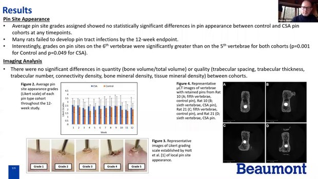 Prevention of External Fixator Pin-Tract Infections Using a Synthetic ...