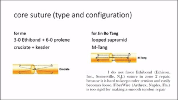 Maximizing Outcomes after Flexor Tendon Injury | Vumedi
