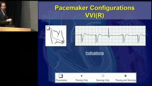 Keeping Pace With Technology: Meet the New Pacemakers. History of ...
