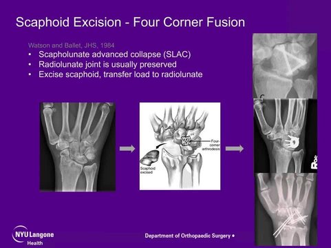 健康・医学 Carpentier's ReconstructiveValveSurgery Amazon | Carpentier's Reconstructive Valve Surgery, 1e