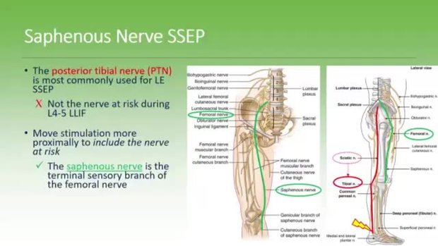 Neuromonitoring and SPS: Is SSEP the New Standard? | Vumedi