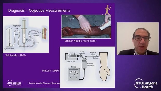Forearm Compartment Syndrome: Decision Making and Surgical Approach ...