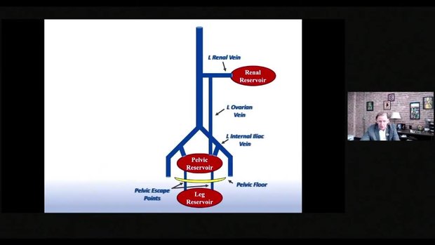 New SVP Classification System for Pelvic Venous Disorders: What Does It ...