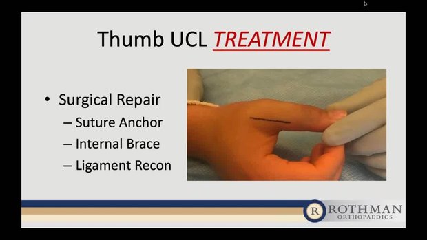 Thumb Ulnar Collateral Ligament (UCL) Injuries: Injury Types ...