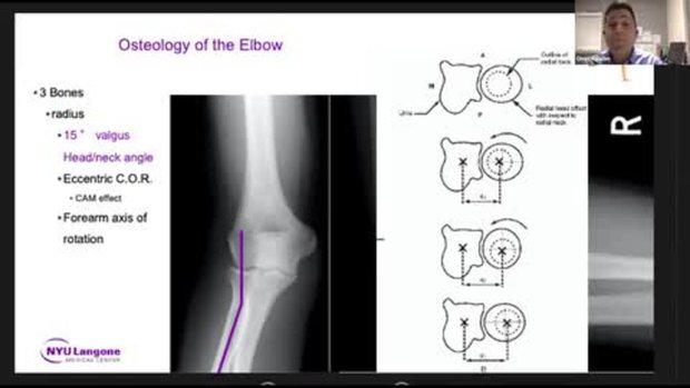 Relevant Anatomy and Useful Surgical Approches When Treating the Elbow ...
