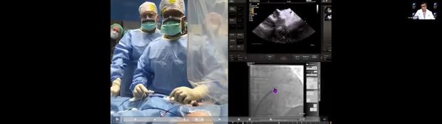 Challenging LAA Case: A Conformable LAA Closure Device | Vumedi