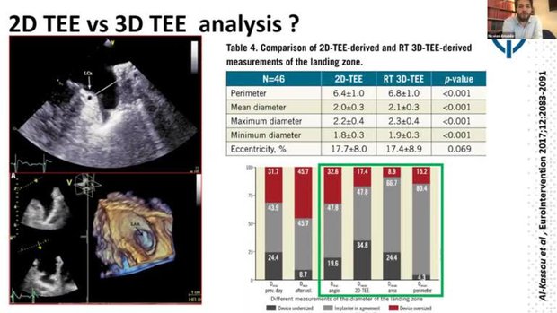 Pre-procedural imaging With TEE: What to Look For? Where to Measure ...