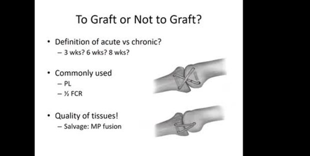 Ligament Injury and Dislocation of the Hand: History and Exam ...