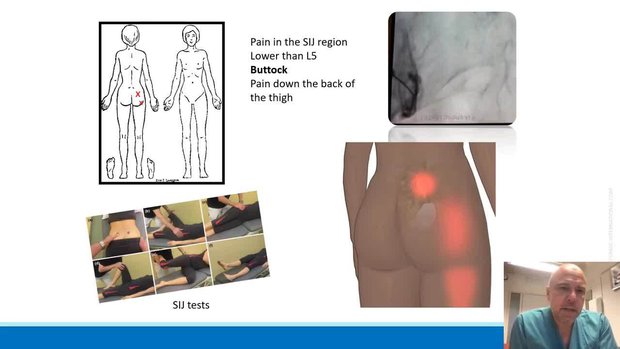Berkovning surati dahshatli