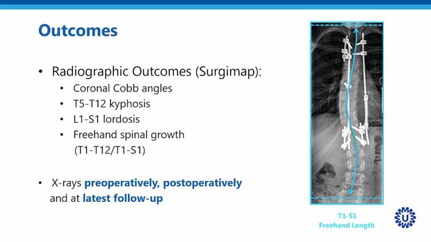 Treating Early Onset Scoliosis with the Spring Distraction System: Are ...