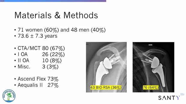 Reverse Shoulder Arthroplasty Using a Monobloc Baseplate with a Hybrid ...