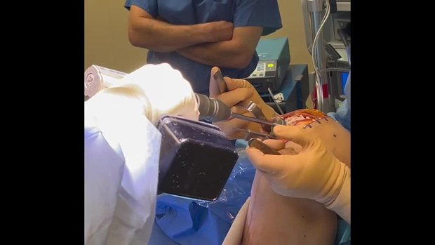 bpc 157 for cartilage BioUni Cartilage Transplant