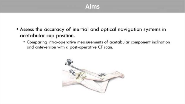 Accurate Acetabular Component Alignment With Surgical Guidance Systems ...
