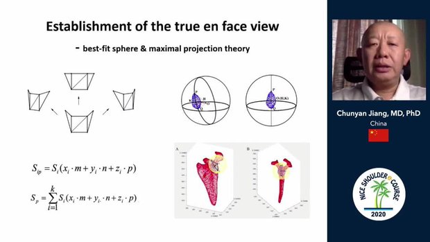 Glenoid Bone Loss Evaluation - the True en Face View | VuMedi