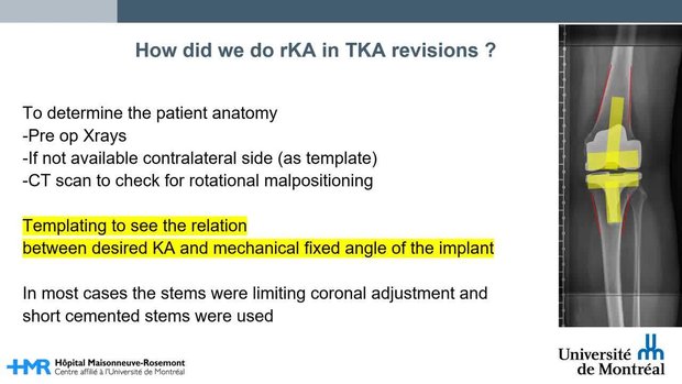 Revision Total Knee Arthroplasty With Restricted Kinematic Alignment ...